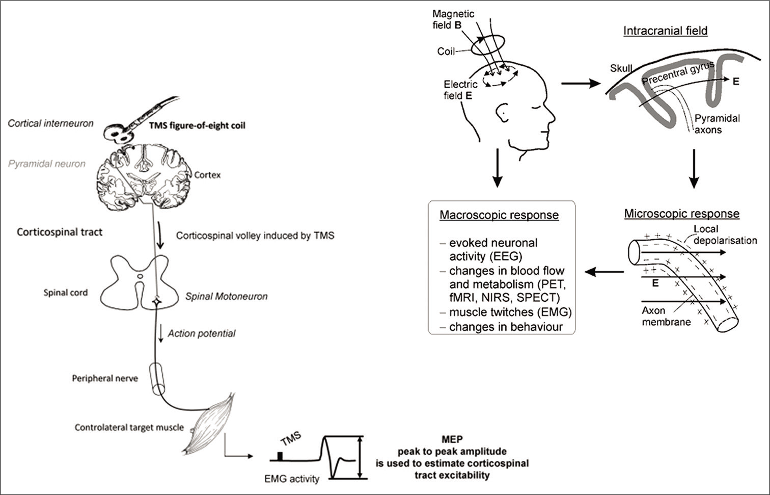 Diagrammatic representation of pathways of transcranial magnetic stimulation stimulation over contralateral motor cortex and conduction along the corticospinal tract to evoke electromyography response in terms of motor evoked potential. [Adapted and modified from Klomjai et al. Annals of Physical and Rehabilitation Medicine 58 (2015) 208–213 and Sack AT, Linden DE. Brain Res Brain Res Rev. 2003 Sep;43(1):41-56].