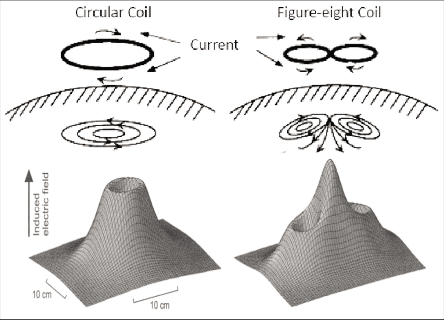 Diagrammatic representation of two commonly used types of transcranial magnetic stimulation coils (circular and figure of 8) and the modeling strength of induced current beneath the scalp. [Adapted and modified from Ge S et al, International Scholarly and Scientific Research & Innovation 6(5) 2012 and Cohen et al., Electroencephalogr Clin Neurophysiol, 75 (1990) 350-7].