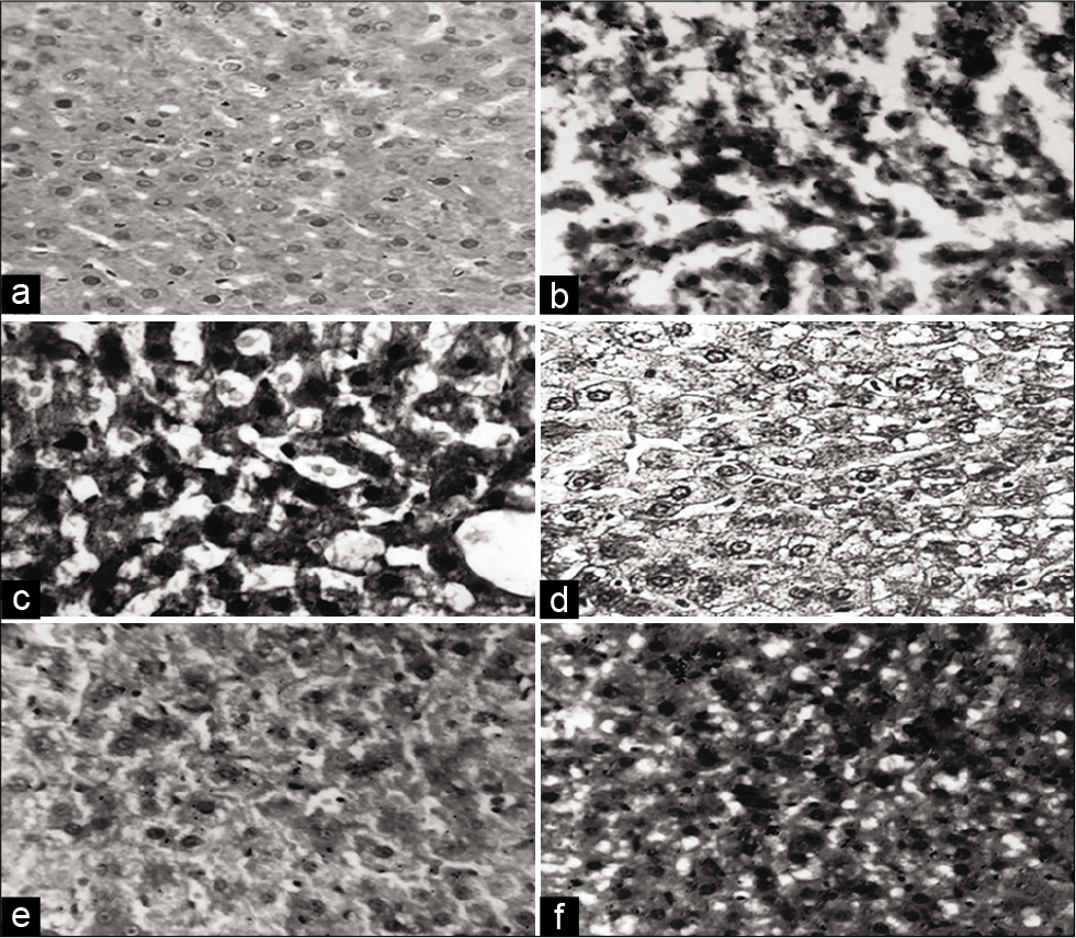 Photomicrograhs of liver sections (H & E staining, 20X). Liver section of (a) Normal control, (b) Disease control, (c) FRE 100mg/kg (d) FRE 200mg/kg (e) FRE 400mg/kg (f) Atorvastatin 20mg/kg.