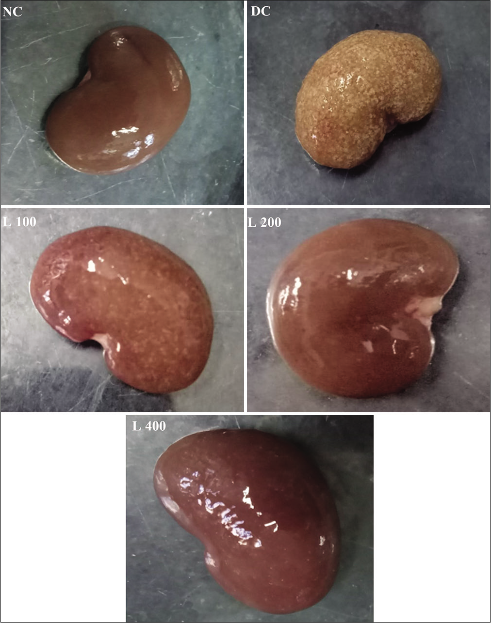 Effect of lycopene on gross morphology of kidney in adenine-induced chronic renal failure in rat. NC: Normal control, DC: Diseases control, L 100: 100 mg/kg Lycopene+Adenine, L 200: 200 mg/kg Lycopene+Adenine, L 400: 400 mg/kg Lycopene+Adenine.
