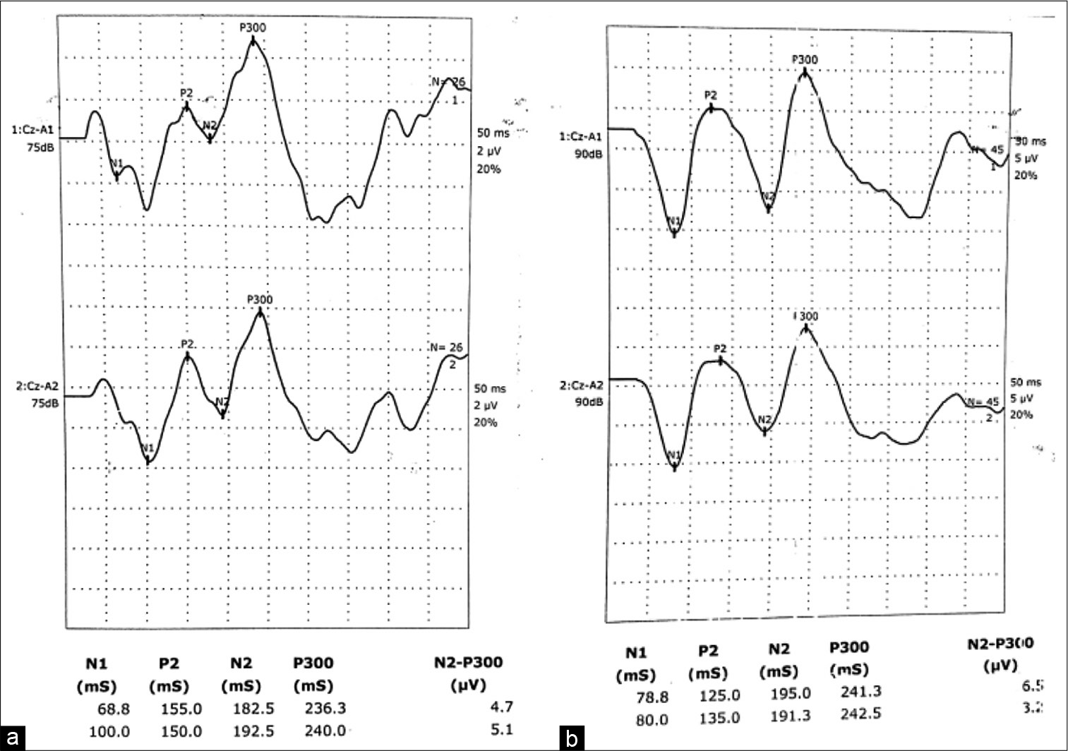 Representative event-related potential waves in subjects (a) and controls (b).