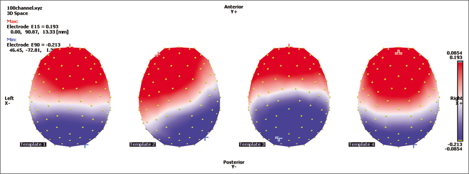 Map topographies as Map-1, Map-2, Map-3 and Map-4 from the left to right sequentially.