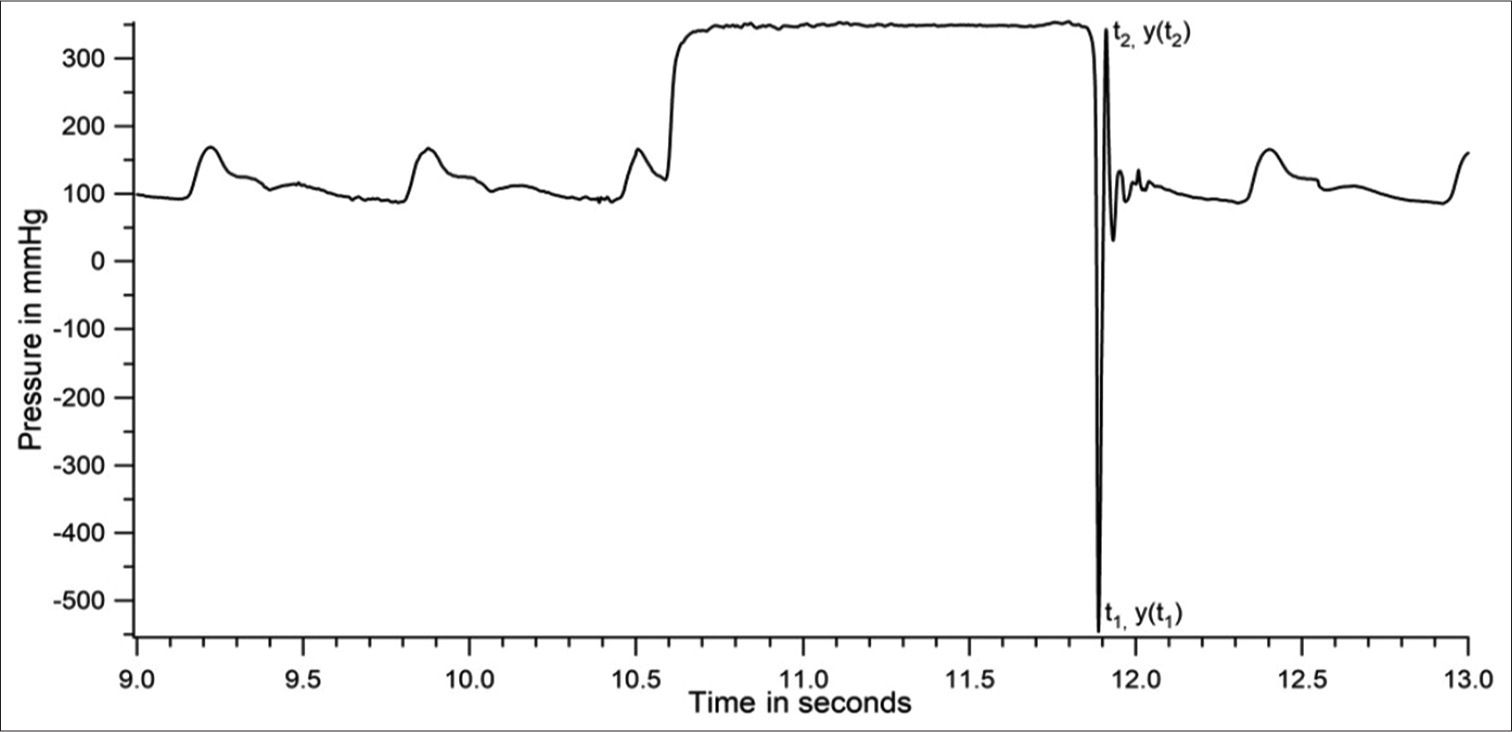 Blood Pressure Variability From Intra-arterial Pressure Recordings In ...