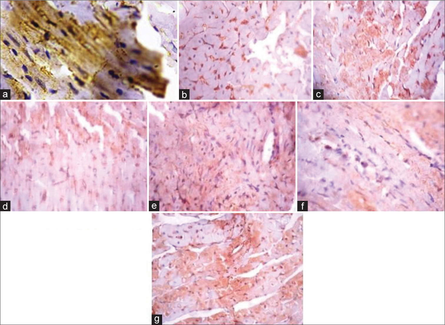 (Plate a-g): Photomicrograph of a heart section stained immunohistochemically for GLUT 4 expression (×400). (a) (Control), (b) (BPA), (c) (DBP), (d) (BPA + Rt), (e) (DBP + Rt), (f) (BPA + DBP) and (g) (BPA + DBP + Rt). Rt: Rutin, BPA: Bisphenol A, DBP: Dibutyl phthalate.