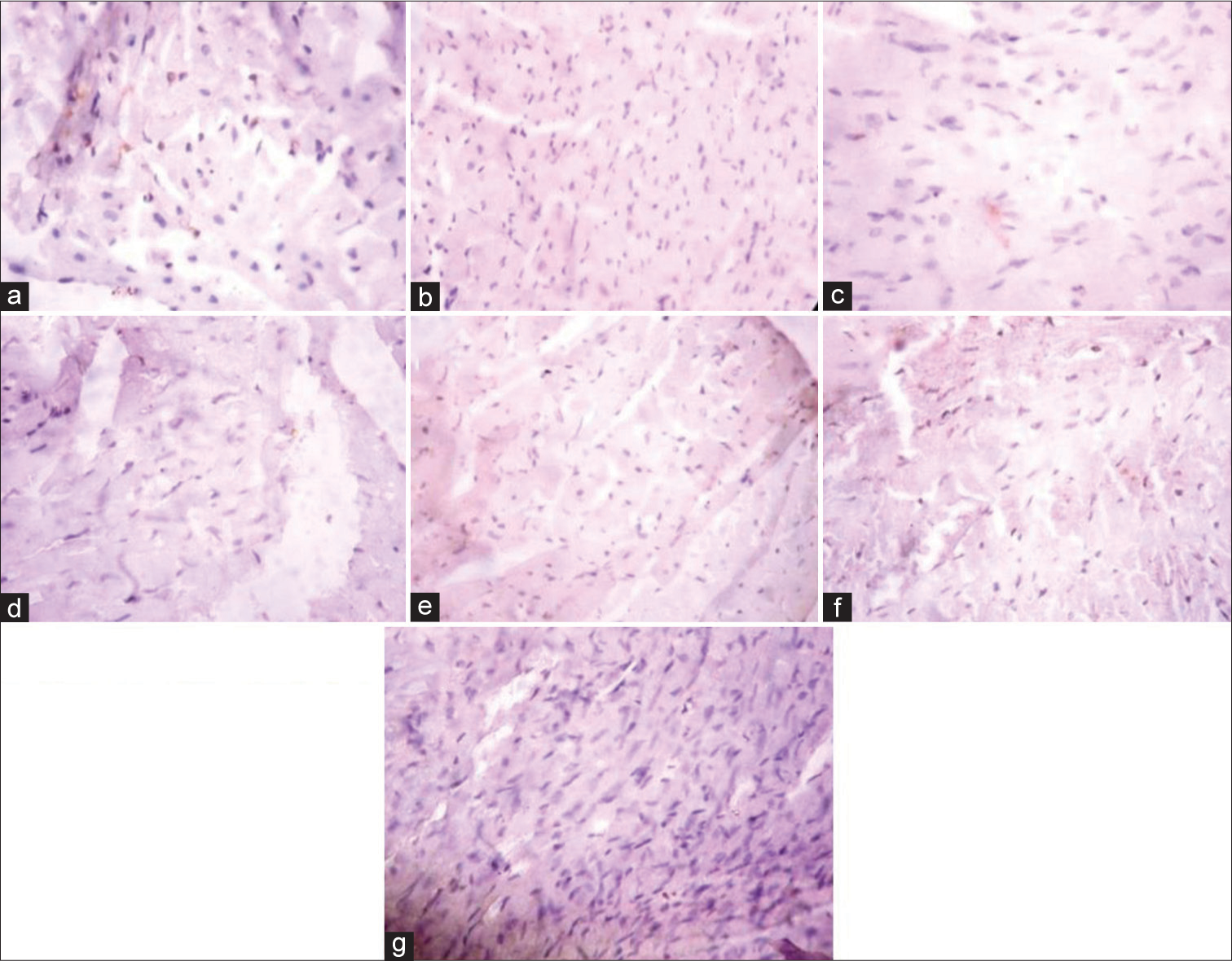 (Plate a-g): Photomicrograph of a heart section stained immunohistochemically for PPARα expression (× 400). (a) (Control), (b) (BPA), (c) (DBP), (d) (BPA + Rt), (e) (DBP + Rt), (f) (BPA + DBP) and (g) (BPA + DBP +Rt). BPA: Bisphenol A, DBP: Dibutyl phthalate, Rt: Rutin.