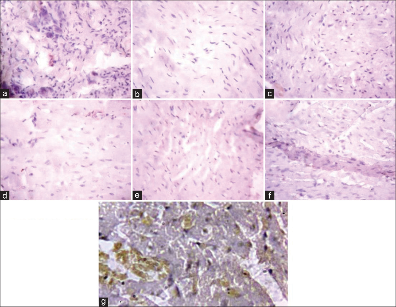 (Plate a-g): Photomicrograph of a heart section stained immunohistochemically for activated protein kinase expression (× 400). (a) (Control), (b) (BPA), (c) (DBP), (d) (BPA + Rt), (e) (DBP + Rt), (f) (BPA + DBP) and (g) (BPA + DBP + Rt). BPA: Bisphenol A, DBP: Dibutyl phthalate, Rt: Rutin.