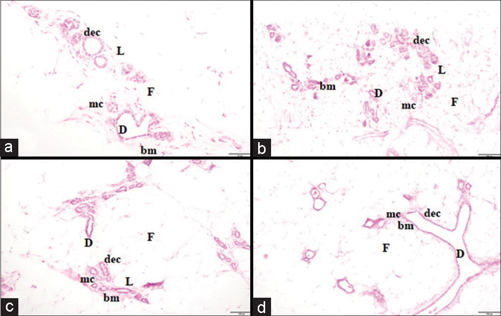 Histopathology (a) NOR, (b) FRC, (c) DMC, and (d) EXC group. The mammary tissue of (a) NOR (alveolar bud stage), (b) FRC (lobular stage), (c) DMC (alveolar bud stage), and (d) EXC (ductal stage) group shows the normal lobular structure (L), ducts (D) and fatty tissue (F) with no evidence of neoplasm (×10). NOR: Normal control, FRC: Fructose control, DMC: DMBA control, EXC: Exposure control, DEC: Ductal epithelial cells, MC: myoepithelial cells.