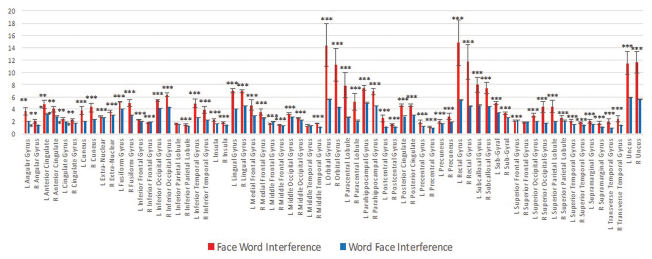 Gyri showing significantly different activity have been compared between Face word and Word face interference. The significant areas (***P < 0.001) have been plotted.