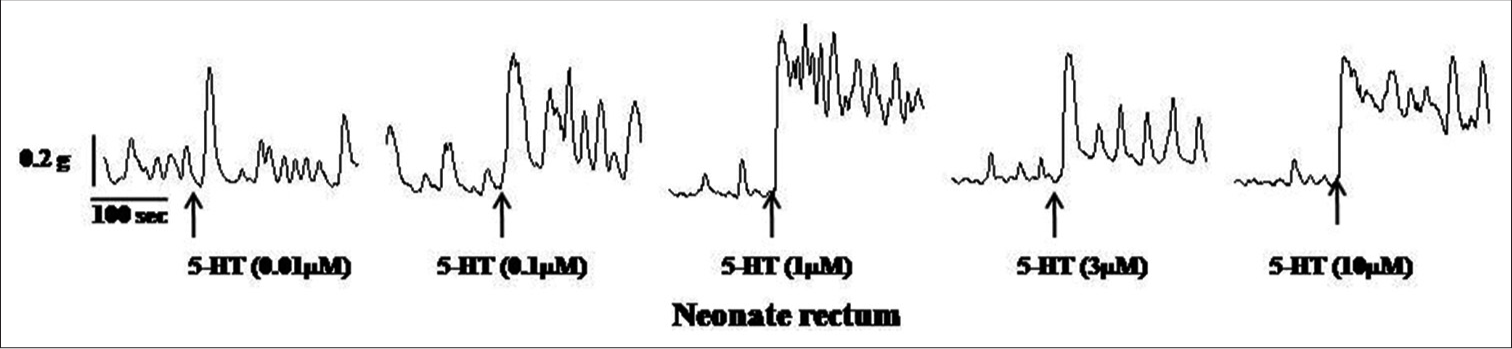 Samples of the original recording of 5-hydroxytryptamine (5 HT) (0.01–10 μM)-induced contractions of the rectum from neonate rats.