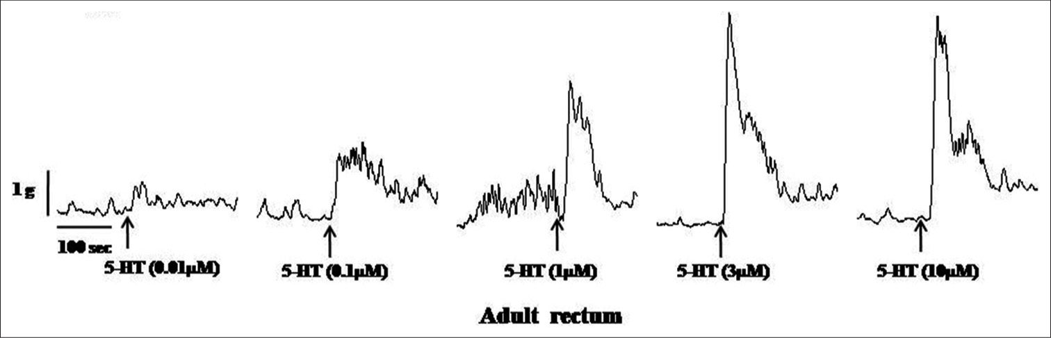Samples of the original recording of 5-hydroxytryptamine (5 HT) (0.01–10 μM)-induced contractions of the rectum from adult rats.
