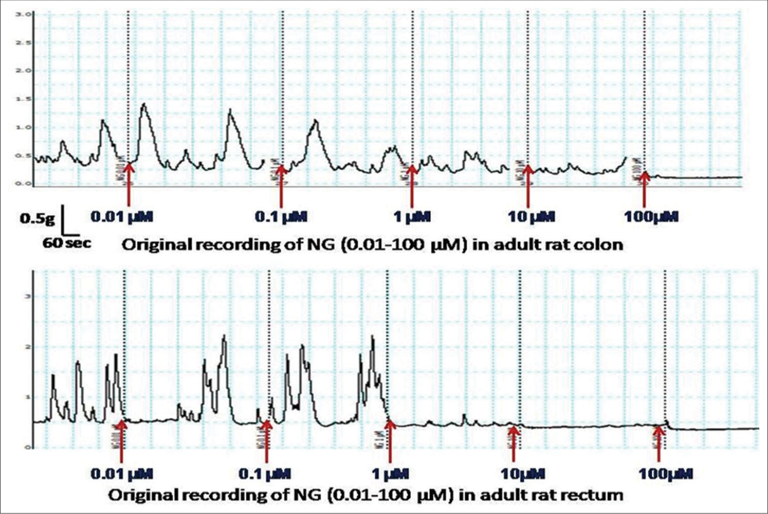 Image showing an original recording of contractile response at different concentrations of nitroglycerin (0.01–100 mM) in the colon and rectum of adult rats.