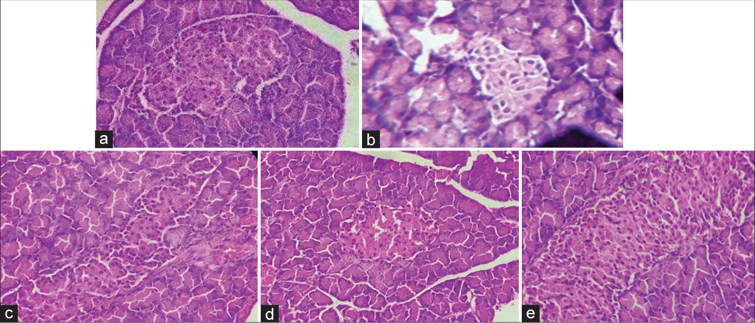 Histopathology of pancreas in high fat diet and streptozotocin induced diabetic nephropathy in Wistar rats (a) Vehicle control, (b) disease control, (c) standard, (d) Mentat 100 mg/kg and (e) Mentat 200 mg/kg.