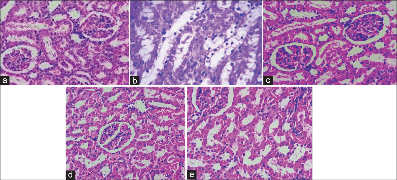 Histopathology of kidneys in high fat diet and streptozotocin induced diabetic nephropathy in Wistar rats (a) vehicle control, (b) disease control, (c) standard, (d) Mentat 100 mg/kg and (e) Mentat 200 mg/kg.