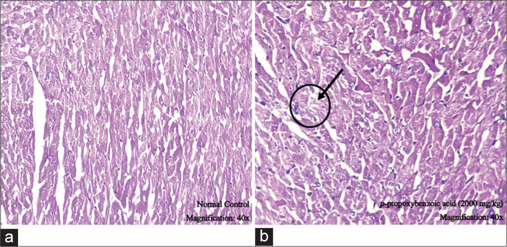 Histopathology of the heart observed at ×40 magnification (a) normal control group and (b) p-propoxybenzoic acid (2000 mg/kg) group (black arrow indicates the presence of cardiac muscle damage).