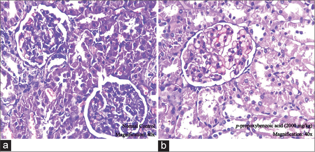 Histopathology of kidney observed at ×40 magnification (a) normal control group and (b) p-propoxybenzoic acid (2000 mg/kg) group.