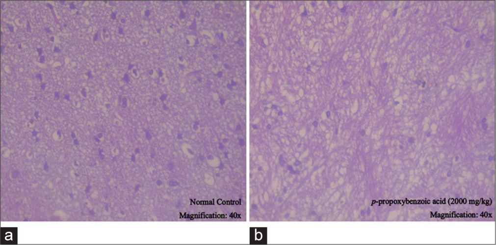 Histopathology of cerebellum observed at ×40 magnification (a) normal control group and (b) p-propoxybenzoic acid (2000 mg/kg) group