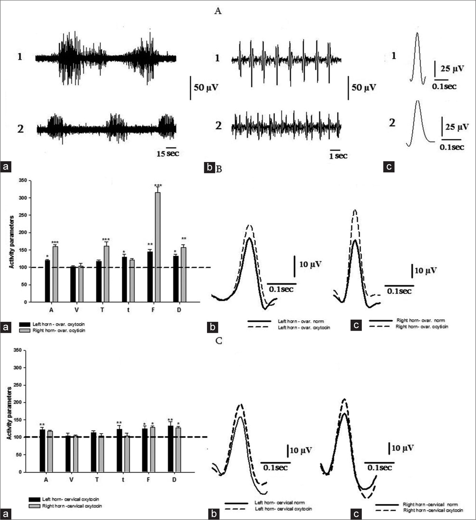 (A) a. Bursts of spikes in the ovarian (1) and cervical (2) areas of the left uterine horn. b. Following each other action potentials, recorded in bursts of the left ovarian and cervical horn areas. c. Averaged forms of action potentials in the corresponding areas. (B) a. The effect of oxytocin on spontaneous electrical activity of the ovarian areas in relation to the norm (dashed line). b. and c. Superimposed on each other, the averaged action potential contours in norm and under the effect of oxytocin. (C) a. The effect of oxytocin on spontaneous electrical activity of the cervical areas in relation to the norm (dashed line). b. and c. Superimposed on each other, the averaged action potential contours in norm and under the effect of oxytocin.