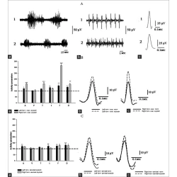 Article figure