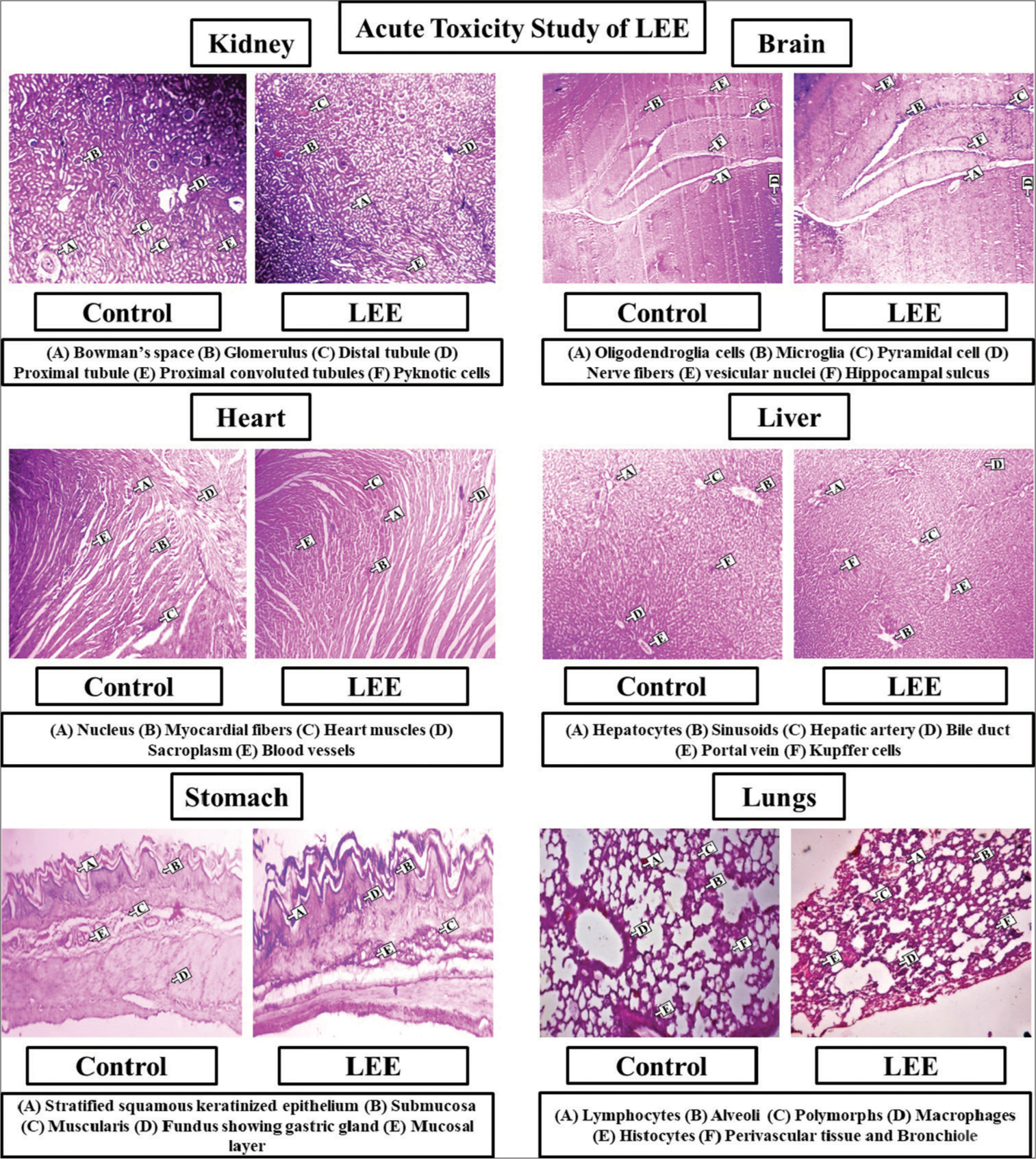 Histopathological observations of different organs in acute toxicity study of Leaf ethanolic extract (LEE).