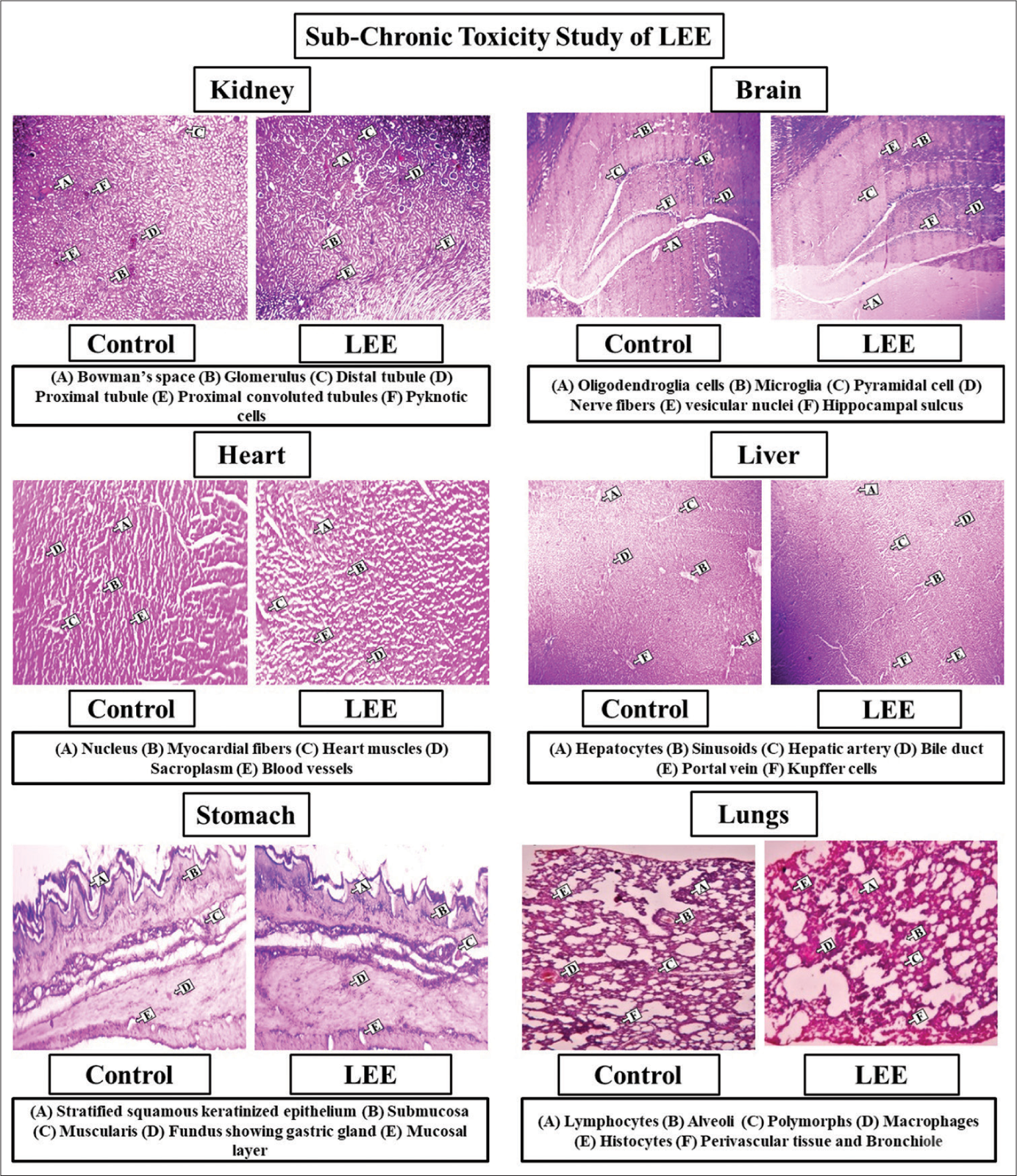 Histopathological observations of different organs in sub-chronic toxicity study of LEE (Leaf ethanolic extract).