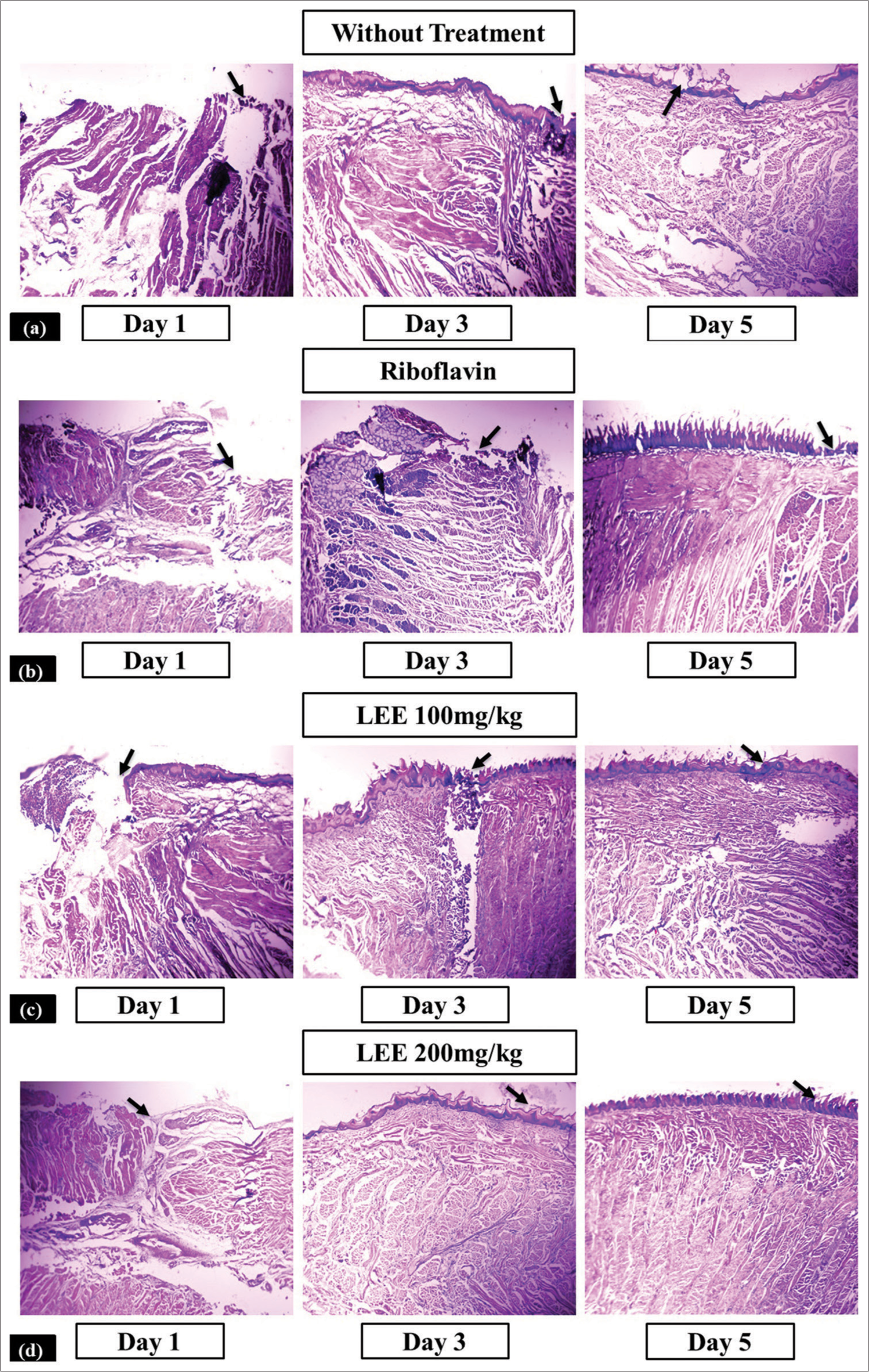 Histopathological analysis of the isolated tongue samples collected from rats on Day 1, Day 3 and Day 5 to evaluate progress in ulcer healing between different treatment groups, (a) Control (ulcer-induced; no treatment) (b) Acetic acid + Riboflavin, (c) Acetic acid + Olax psittacorum leaf ethanolic extract (LEE-100 mg/kg, p.o.) and (d) Acetic acid + O. psittacorum leaf ethanolic extract (LEE; 200 mg/kg; p.o.). Black arrow in the figures indicates disruption and normal development of epithelial cells of the tongue. LEE: Leaf ethanolic extract.