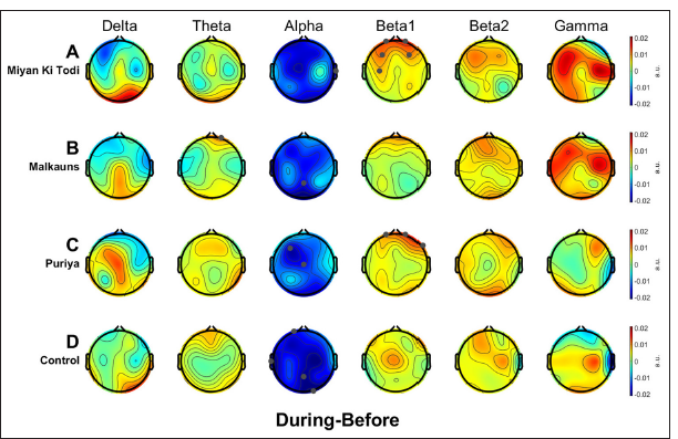 Scalp maps representing the average changes in electrode-level band power during intervention relative to before intervention, within each group (First-level analysis). Negative values (indicated in cooler colors) would mean a decrease in power spectral values and positive values (indicated in warmer colors) mean an increase relative to the Before Music condition. Statistically significant electrode sites after robust t-test with cluster-based multiple comparison correction (tfce) are denoted by grey dots. The clean data (at least 3 min per subject) from the middle 7 min of the intervention period were used for this analysis.