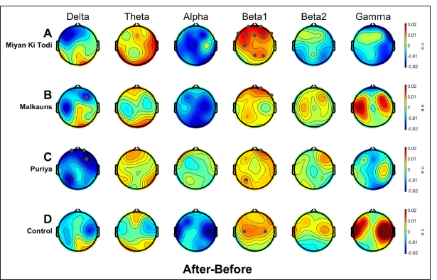 Scalp maps representing the average electrode-level band power changes after intervention relative to before intervention, within each group (First-level analysis). Negative values (indicated in cooler colors) would mean a decrease in power spectral values and positive values (indicated in warmer colors) mean an increase relative to the before music condition. Statistically significant electrode sites after robust t-tests with cluster-based multiple comparison corrections (tfce) are denoted by grey dots. The clean data (at least 3 min per subject) from the middle 7 min of the intervention period were used for this analysis.