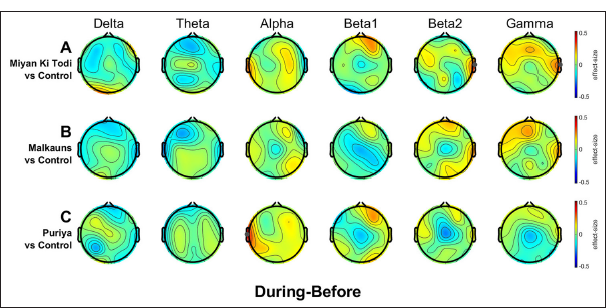 Scalp maps showing the differences between the groups in electrode-level band power between the intervention and control groups (Second-level analysis) during the intervention relative to before the intervention. Negative values (indicated in cooler colors) would mean a decrease in power spectral values and positive values (indicated in warmer colors) mean an increase relative to the control group. Statistically significant electrode sites after robust t-test with cluster-based multiple comparison correction (tfce) are denoted by grey dots. The clean data (at least 3 min per subject) from the middle 7 min of the intervention period were used for this analysis.