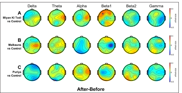 Scalp maps showing group differences in electrode-level band power between the intervention and control groups (Second-level analysis) after intervention relative to before intervention. Negative values (indicated in cooler colors) would mean a decrease in power spectral values and positive values (indicated in warmer colors) mean an increase relative to the control group. Statistically significant electrode sites after robust t-tests with cluster-based multiple comparison corrections (tfce) are denoted by grey dots. The clean data (at least 3 min per subject) from the middle 7 min of the intervention period were used for this analysis.