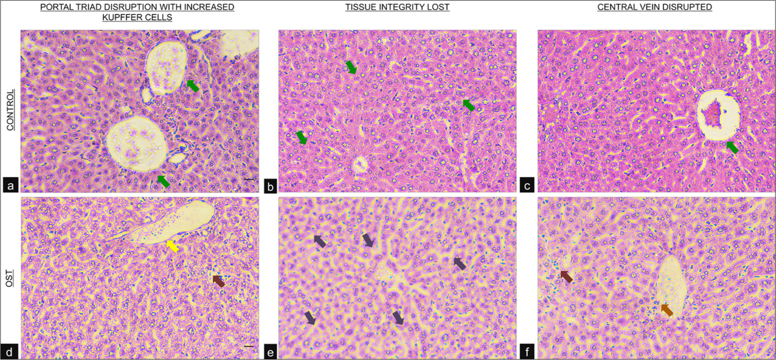 Histopathological changes (20×; scale bar represents 50 micrometer) in (a-c) Control and (d-f) Ostarine administered mice: OST using H&E staining. The green arrows show the healthy histoarchitecture of Control hepatic tissue whereas the yellow arrow represents the disrupted portal triad with red arrows depicting increased Kupffer cells. The purple arrows show the loss of tissue integrity at multiple regions and the orange arrow represents that disformed central vein.