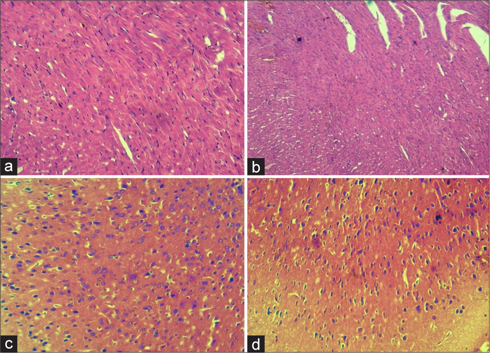 Histopathology of rat heart. This figure provides a clear visual representation of the observed differences among the groups. With (a) standard drug (Atenolol), (b) the one with high salt diet, (c-d) both the doses of Saussurea lappa extract. The groups subjected to the extract treatment display intermediate outcomes, positioned between the normal control and disease control groups. Histologically, most of the cardiac tissue appeared normal. Cardiac myocytes and endocardium appeared normal. Few congested vessels are seen in fructose induced group. Overall, no inflammation or any degenerative lesion were seen.